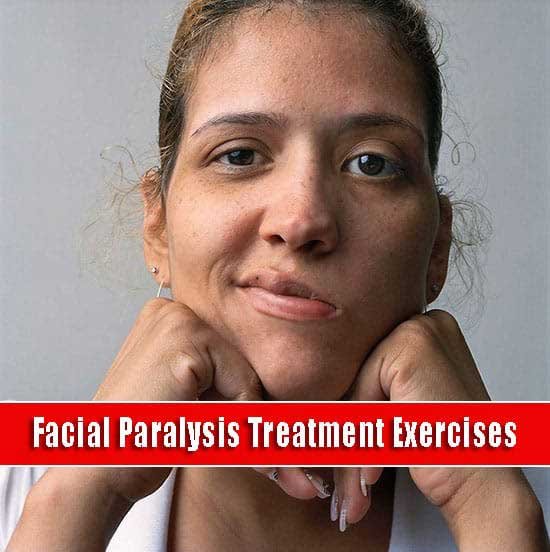 Facial Paralysis Treatment Exercises