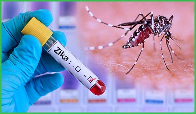 Zika Virus